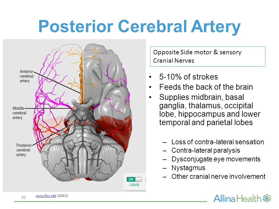 signs of a stroke for women