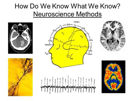How Do We Know What We Know? Neuroscience Methods.