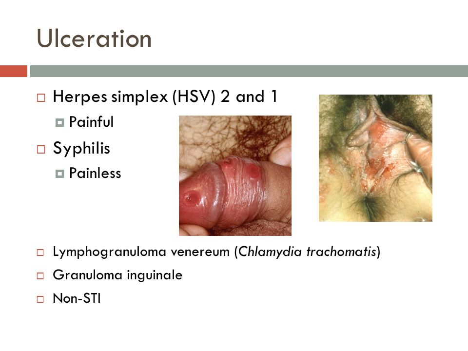 download apoptosis senescence and