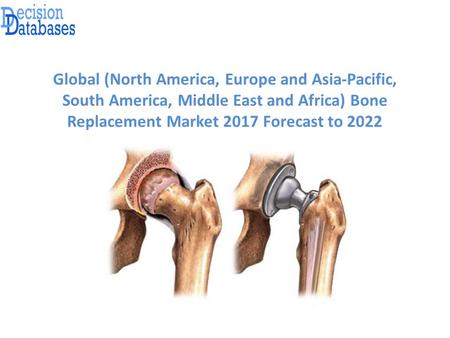 Global (North America, Europe and Asia-Pacific, South America, Middle East and Africa) Bone Replacement Market 2017 Forecast to 2022.