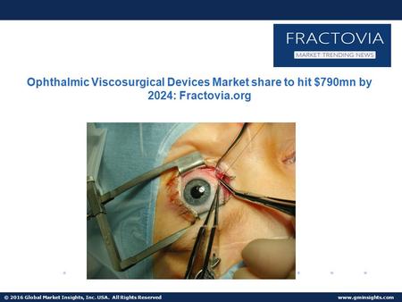 © 2016 Global Market Insights, Inc. USA. All Rights Reserved  Europe Ophthalmic Viscosurgical Devices Market to hit $230mn by 2024.