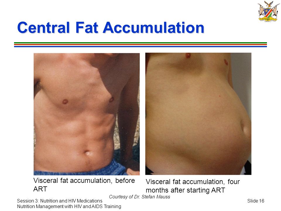 Fat Accumulation 41