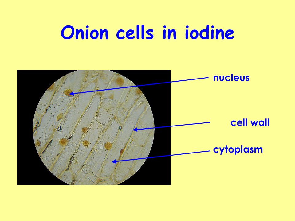 Onion+cells+in+iodine+nucleus+cell+wall+cytoplasm+10