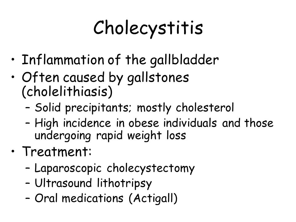 Gallstones Caused By Rapid Weight Loss