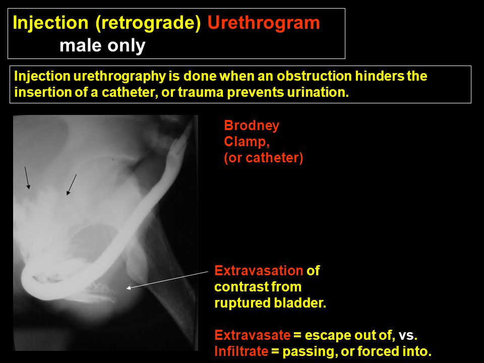 cystography retrograde urography ppt download retrograde urethrogram