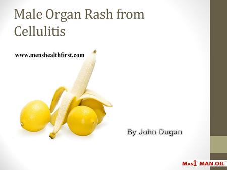 Male Organ Rash from Cellulitis