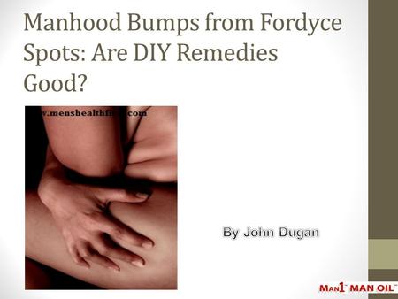 Manhood Bumps from Fordyce Spots: Are DIY Remedies Good?