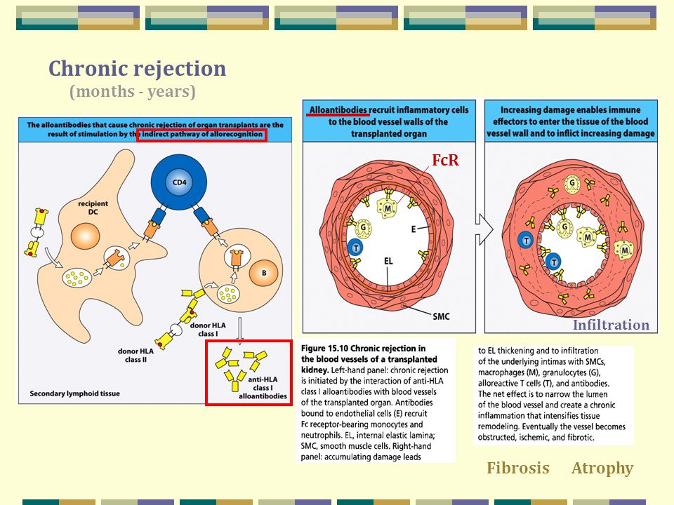 transplant rejection,hairtransplant responses to alloantigens and transplant rejection