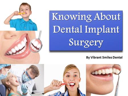 Knowing About Dental Implant Surgery
