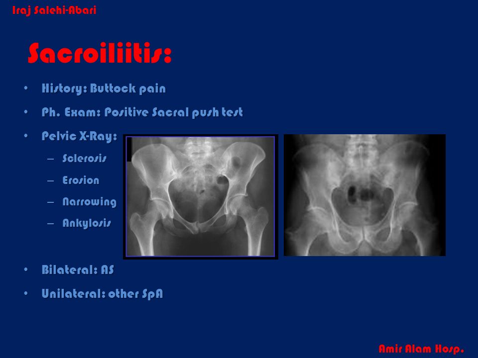 Rheuma bei Kindern und Jugendlichen in der Physio- und Ergotherapie