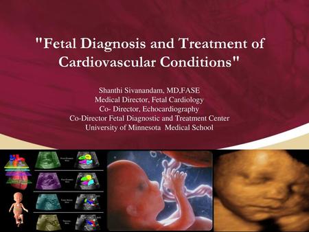 Fetal Diagnosis and Treatment of Cardiovascular Conditions Shanthi Sivanandam, MD,FASE Medical Director, Fetal Cardiology Co- Director, Echocardiography.