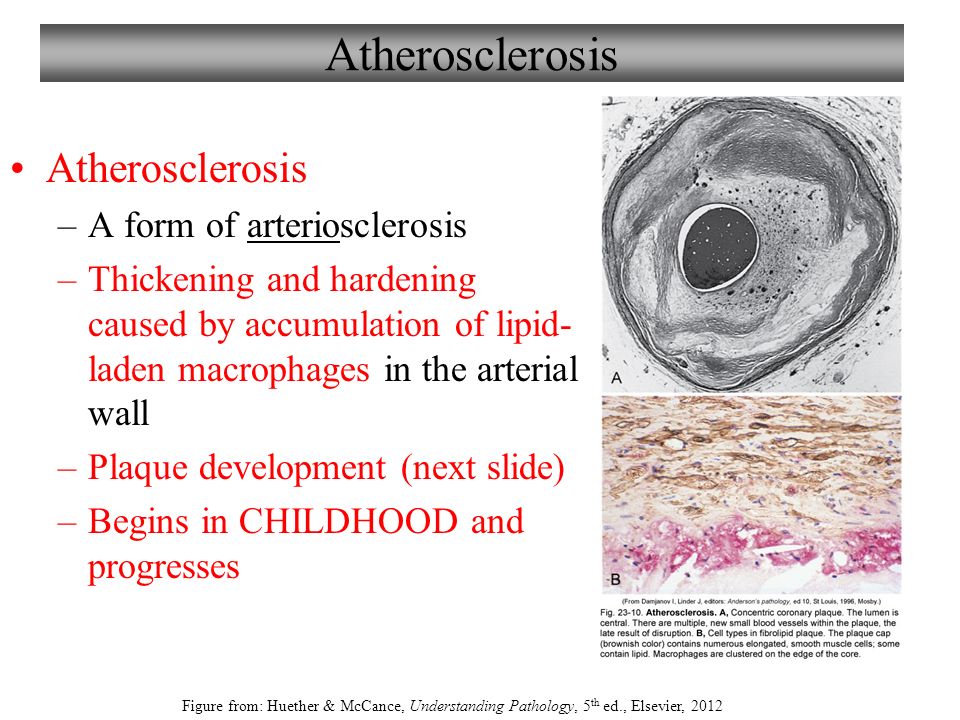 Damjanov Pathophysiology Pdf Porth Damjanov Pathophysiology Pdf Porth