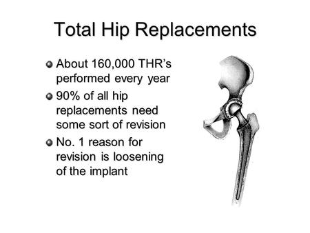 Total Hip Replacements About 160,000 THRs performed every year 90% of all hip replacements need some sort of revision No. 1 reason for revision is loosening.