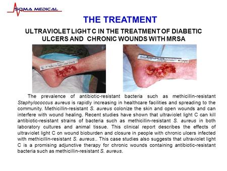 ULTRAVIOLET LIGHT C IN THE TREATMENT OF DIABETIC ULCERS AND CHRONIC WOUNDS WITH MRSA The prevalence of antibiotic-resistant bacteria such as methicillin-resistant.