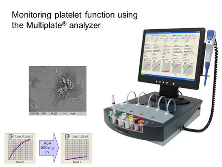 Monitoring platelet function using the Multiplate® analyzer