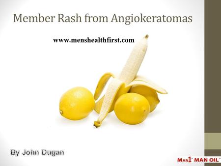 Member Rash from Angiokeratomas