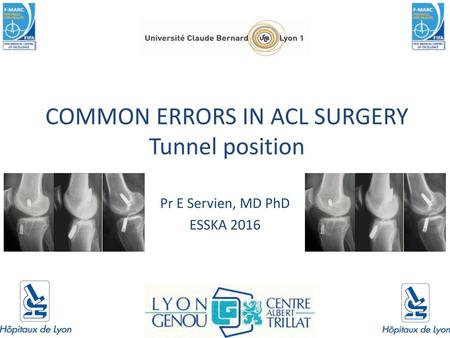 COMMON ERRORS IN ACL SURGERY Tunnel position