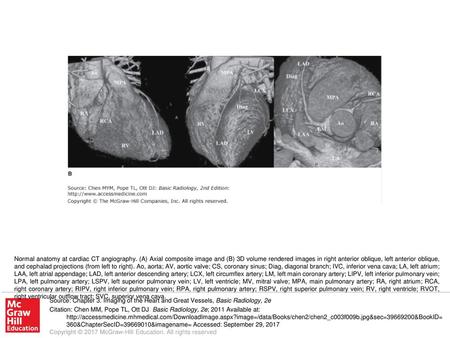 Normal anatomy at cardiac CT angiography