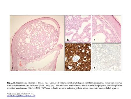 Fig. 2. Histopathologic findings of present case