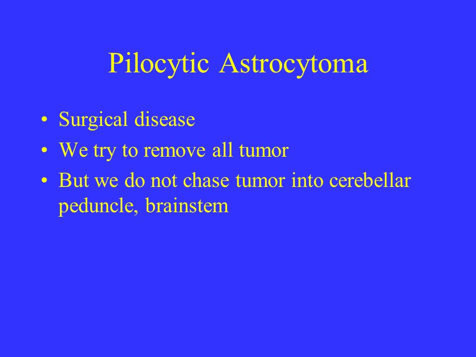 Astrocytoma In Adults 117