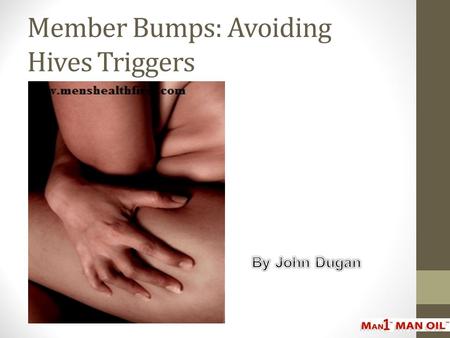 Member Bumps: Avoiding Hives Triggers