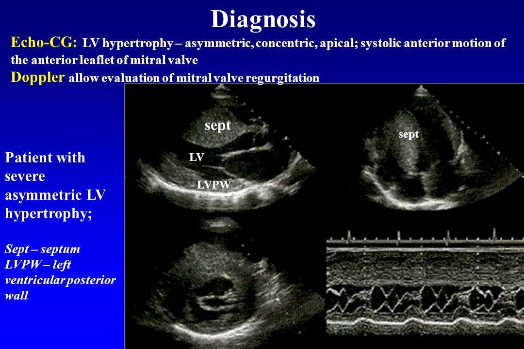 ebook tendinopathy in