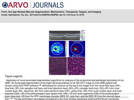Invest. Ophthalmol. Vis. Sci ;54(14):ORSF68-ORSF80. doi: /iovs