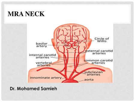MRA Neck Dr. Mohamed Samieh.