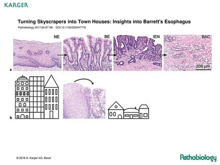 Turning Skyscrapers into Town Houses: Insights into Barrett's Esophagus Pathobiology 2017;84:87-98 - DOI:10.1159/000447779 Fig. 1.a BE develops via conversion.