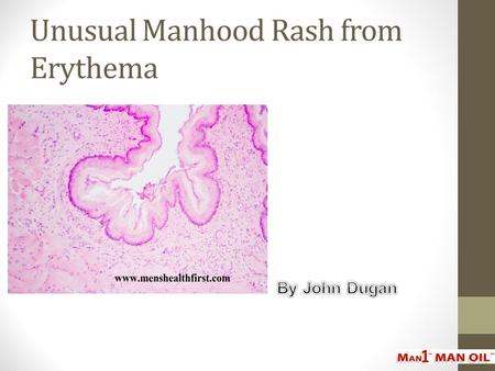 Unusual Manhood Rash from Erythema