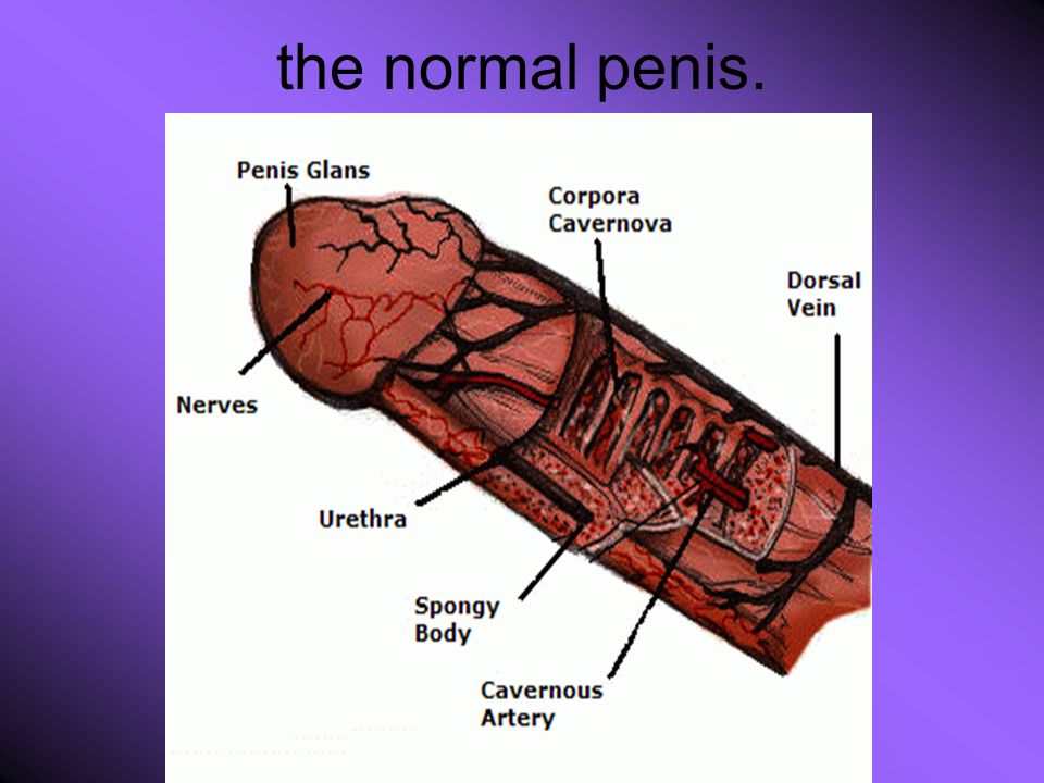 Picture Of A Normal Penis 101