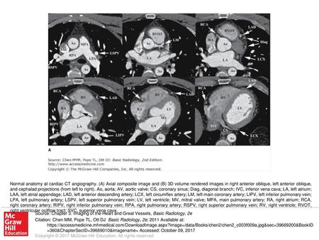 Normal anatomy at cardiac CT angiography