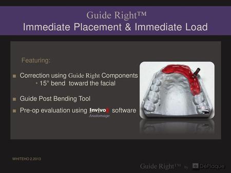 Guide Right™ Immediate Placement & Immediate Load
