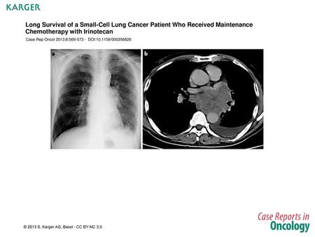 Long Survival of a Small-Cell Lung Cancer Patient Who Received Maintenance Chemotherapy with Irinotecan Case Rep Oncol 2013;6:569-573 - DOI:10.1159/000356826.