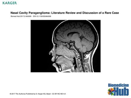 Nasal Cavity Paraganglioma: Literature Review and Discussion of a Rare Case Biomed Hub 2017;2:464099 - DOI:10.1159/000464099 © 2017 The Author(s) Published.
