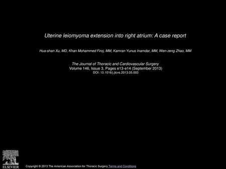 Uterine leiomyoma extension into right atrium: A case report