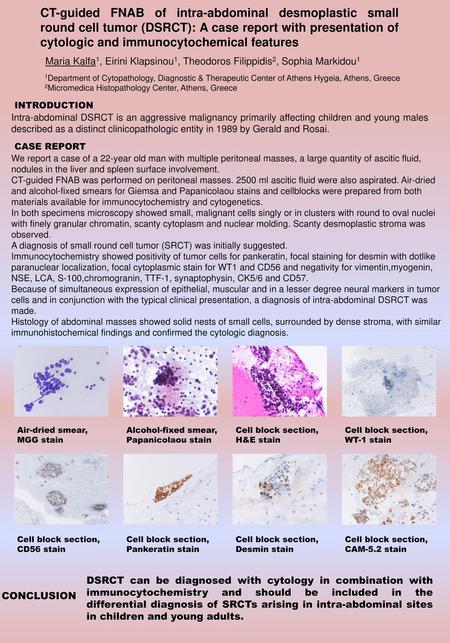CT-guided FNAB of intra-abdominal desmoplastic small round cell tumor (DSRCT): A case report with presentation of cytologic and immunocytochemical features.