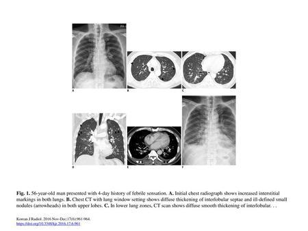 Fig year-old man presented with 4-day history of febrile sensation. A