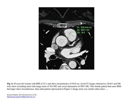 45-year-old woman with BMI of 23.1 and chest circumference of 94.0 cm. Axial CT images obtained at 120 kV and 200 mAs show ascending aorta with image noise.