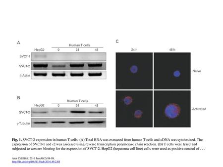 Fig. 1. SVCT-2 expression in human T cells