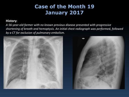Case of the Month 19 January 2017