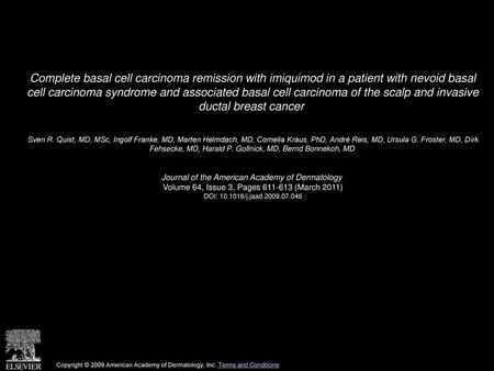 Complete basal cell carcinoma remission with imiquimod in a patient with nevoid basal cell carcinoma syndrome and associated basal cell carcinoma of the.