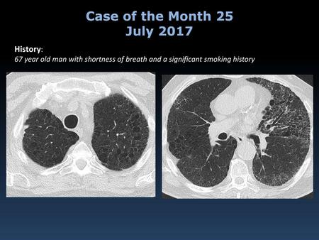 Case of the Month 25 July 2017 History:
