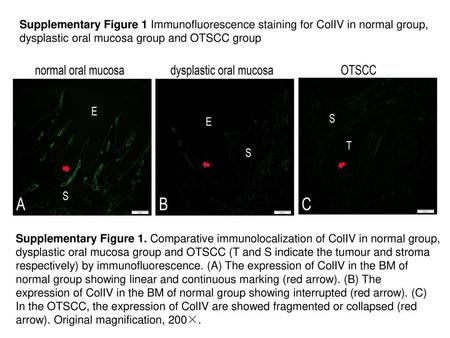Supplementary Figure 1 Immunofluorescence staining for ColIV in normal group, dysplastic oral mucosa group and OTSCC group Supplementary Figure 1. Comparative.