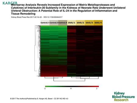 Microarray Analysis Reveals Increased Expression of Matrix Metalloproteases and Cytokines of Interleukin-20 Subfamily in the Kidneys of Neonate Rats Underwent.