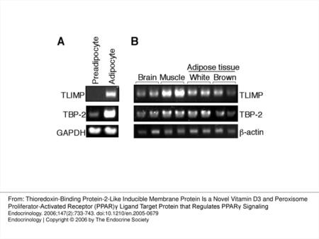Fig. 6. Expression of TLIMP and TBP-2 in adipose cells and tissues