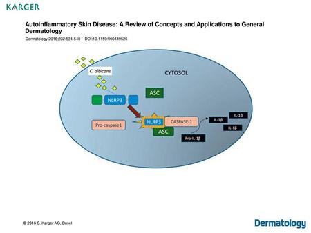 Autoinflammatory Skin Disease: A Review of Concepts and Applications to General Dermatology Dermatology 2016;232:534-540 - DOI:10.1159/000449526 Fig.