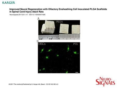 Improved Neural Regeneration with Olfactory Ensheathing Cell Inoculated PLGA Scaffolds in Spinal Cord Injury Adult Rats Neurosignals 2017;25:1–14 - DOI:10.1159/000471828.