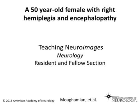 A 50 year-old female with right hemiplegia and encephalopathy