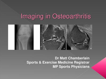 Imaging in Osteoarthritis